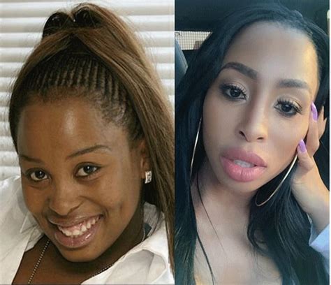 Khanyi Mbau Cosmetic Surgery Include Breast Implants See The Cost