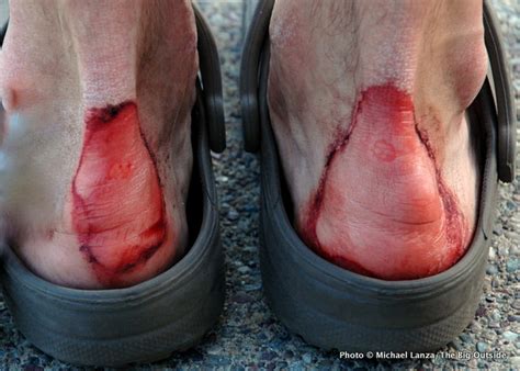 8 Pro Tips For Preventing Blisters When Hiking The Big Outside