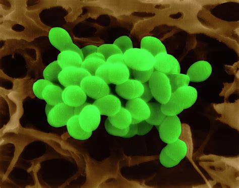 Enterococcus Faecalis Photograph By Dennis Kunkel Microscopyscience