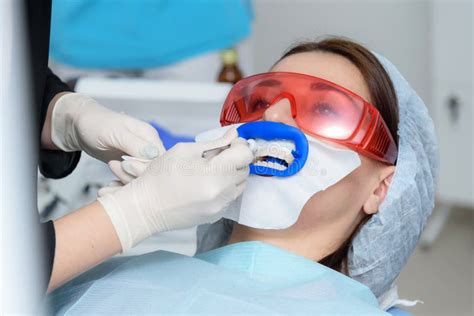 Preparing The Oral Cavity For Whitening With An Ultraviolet Lamp Close Up Stock Image Image