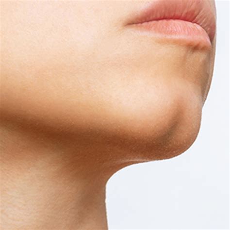 What Causes Cleft Chin The Tech Interactive