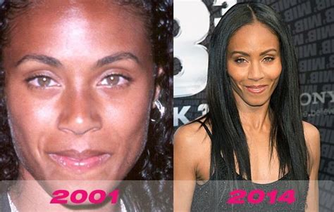 Jada Pinkett Smith Before And After Plastic Surgery 05 Celebrity