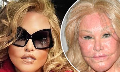Declare Guidelines Wildenstein Plastic Surgery Torrent To Disable