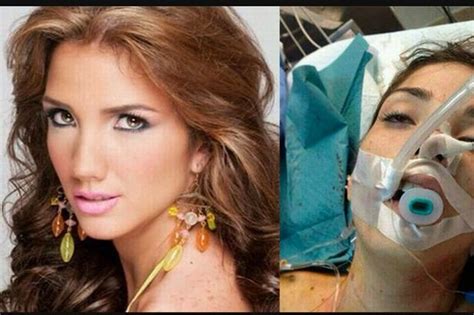 Beauty Queen Genesis Carmona Killed By Gunmen In Anti Government Venezuelan Protests