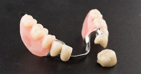 Removable Partials And Dentures Azusa Restorative Dental