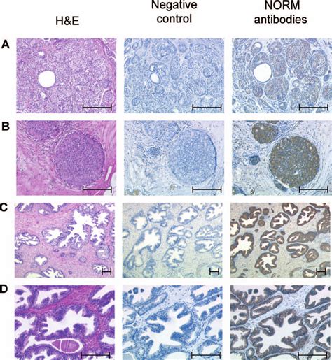 Immunohistochemical staining of antibodies isolated from healthy 