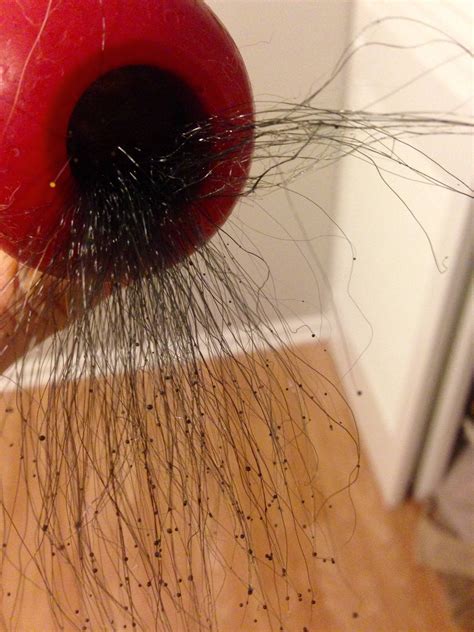 Mold That Looks Like Hair Found In My Dogs Old Kong Biology