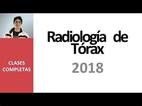 Curso De Radiografia De T Rax Aula I Analisando Radiografia De