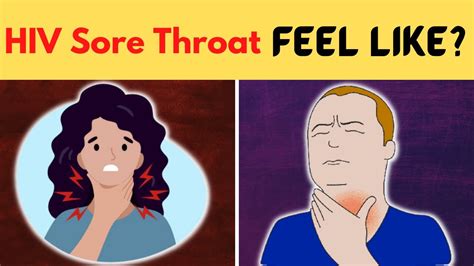 What Does Hiv Sore Throat Feel Like Youtube