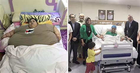 Worlds Heaviest Woman Eman Ahmed Abd El Aty Loses Half Her Weight In
