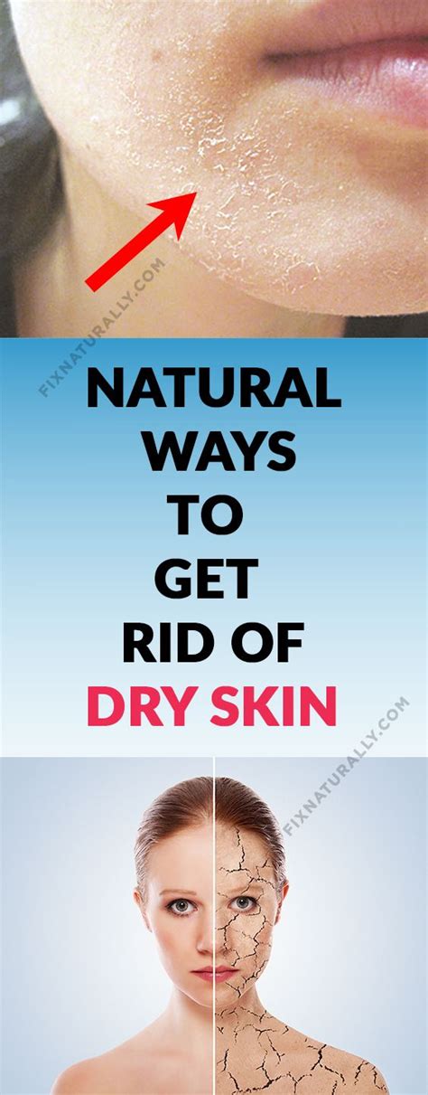 Home Remedies For Dry Skin Dryskin Dry Skin On Face Dry Skin