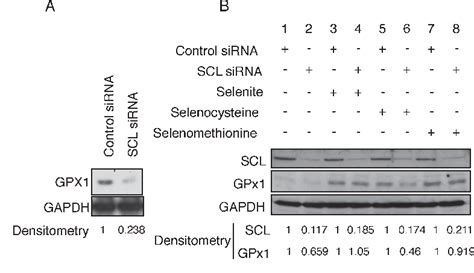 figure 1 from mammalian selenocysteine lyase is involved in selenoprotein biosynthesis