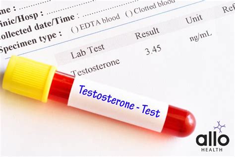 Dr Simran Shamanur Understanding Low Testosterone Icd 10 Allo Health Allo Health