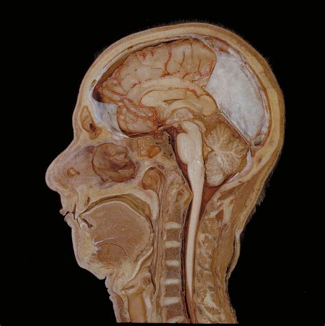 Midline Section Of A Human Head And Neck 1020x1024 R