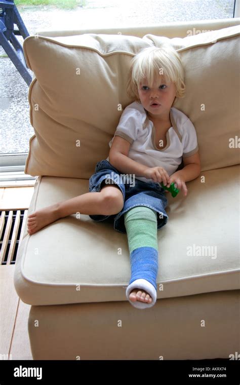 Little Boy With A Broken Leg Sitting On A Bench Stock Photo Alamy