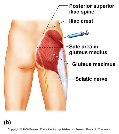 In order to best help your clientele, it's important for coaches to understand the muscles of the back, what can cause back pain, and treatments (after physical therapy, of course.). Gluteal Region Anatomy and Significance | Bone and Spine