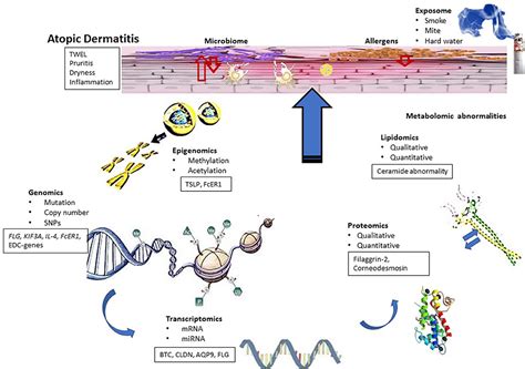 Frontiers Leveraging Multilayered “omics” Data For Atopic Dermatitis