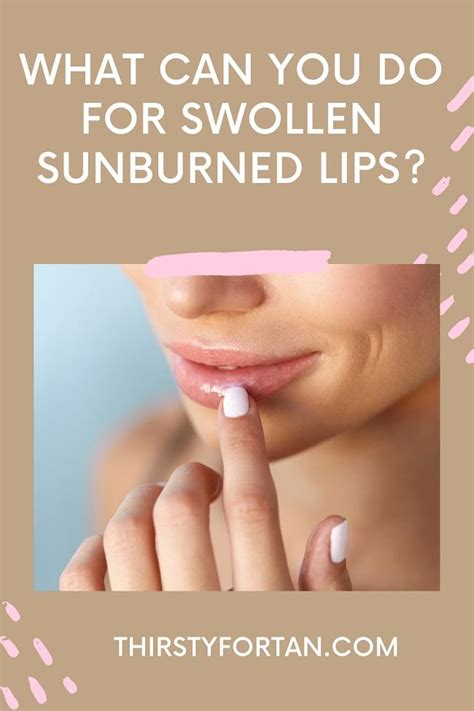 What Can You Do For Swollen Sunburned Lips 3 Home Remedies