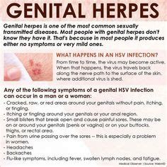 Genital Herpes HSV2 Natural Remedy Cold Sores