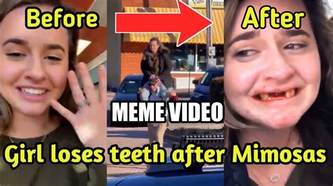 Girl Loses Teeth After Having Too Many Mimosas Viral Video Of Tiktok