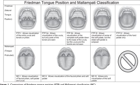 Diagnostic Value Of The Friedman Tongue Position And Mallampati
