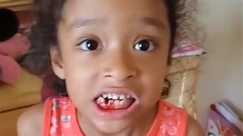 You may want to check with your dentist to get his take on pulling teeth at home. Little girl does exercise routine to pull loose tooth ...