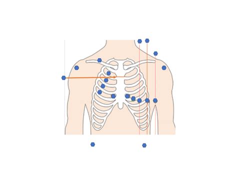 Ekg Lead Placement — Printable Worksheet