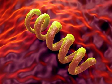 Syphilis Définition Symptômes Traitements Sciences Et Avenir