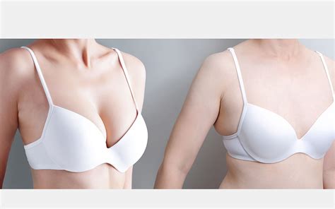 What Do Perfect Breasts Look Like