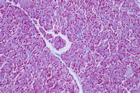 Human Liver Tissue Light Micrograph Stock Image F0324119