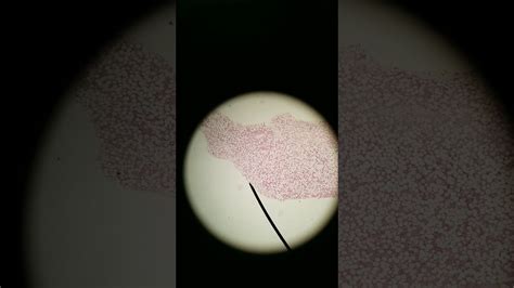 Long Bone Labeled Red Marrow ~ Histology Lab Supportive Tissue