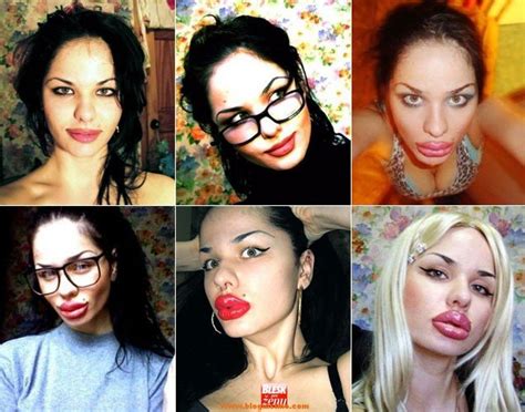 la mujer con los labios más grandes del mundo se ha operado ya 100 veces bloguisimo