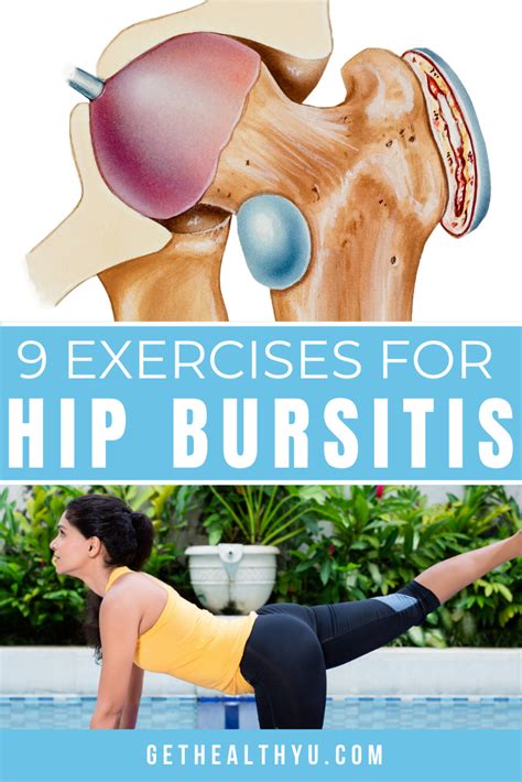 Exercises To Treat Hip Bursitis Bursitis Hip Bursitis Hip The Best Porn Website