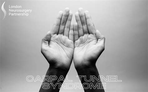 Carpal Tunnel Syndrome London Neurosurgery Spine