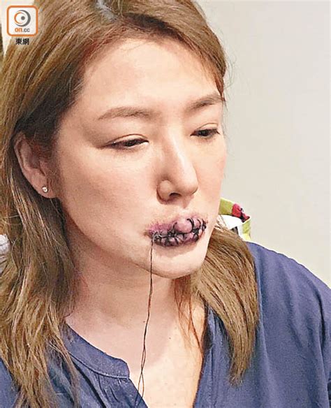 Hksar Film No Top 10 Box Office [2018 02 09] Emily Kwan Gets Her Mouth Sewn Shut