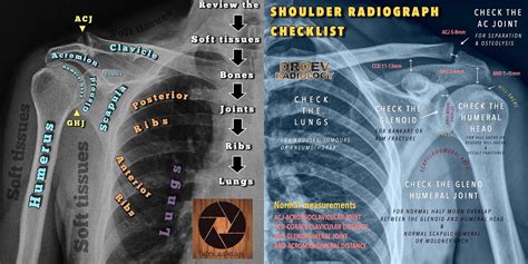 Pelvic X Ray Anatomy And Interpretation Checklist Gre