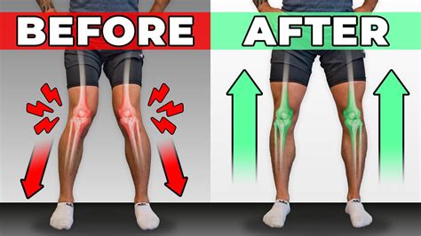 How To Unfck Your Knees In 10 Minutesday Corrective Routine