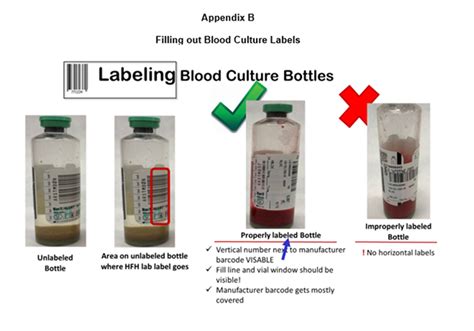 How To Draw Blood Cultures From A Picc Line Foundationinformation