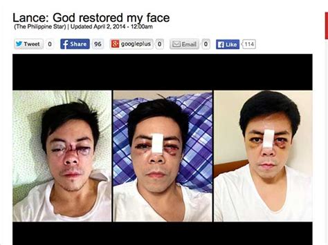 Lance Raymundo Photos After Accident Make Us Weak At The Knees Coconuts