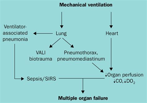 Ventilator Associated Lung Injury The Lancet