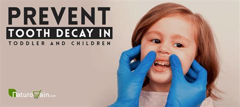 How To Prevent Tooth Decay In Toddlers And Children