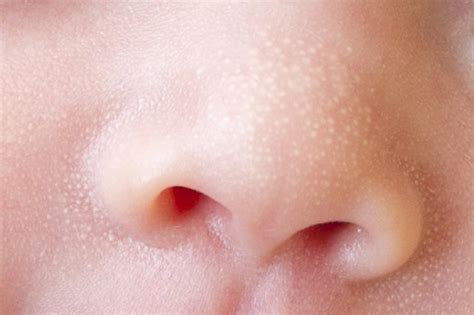 Toddler Rashes 18 Common Skin Conditions That Affect Young Children