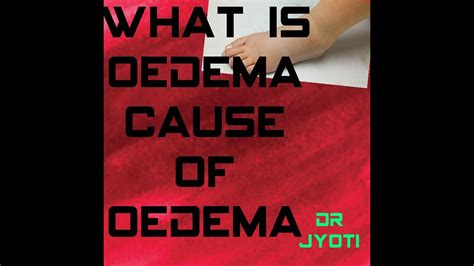 What Is Oedema And Cause Pedal Oedema Pitting Oedeme Localised