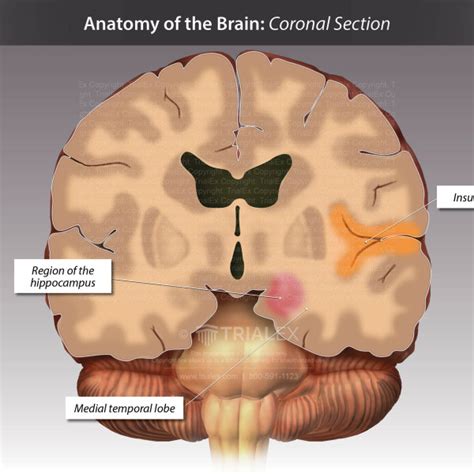 Anatomy Of The Brain Coronal Cut Away View Trialexhibits Inc