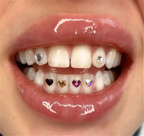 Pin By Ciaraaa On Bling Bling Tooth Gem Diamond Teeth Teeth Jewelry