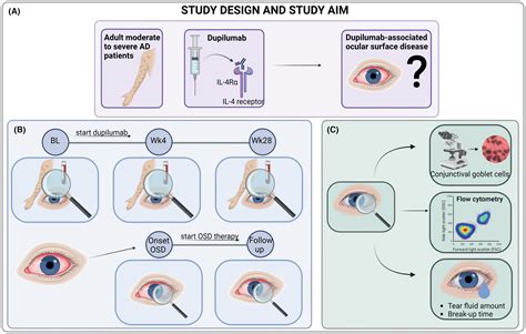 Dupilumab‐associated Ocular Surface Disease In Atopic Dermatitis