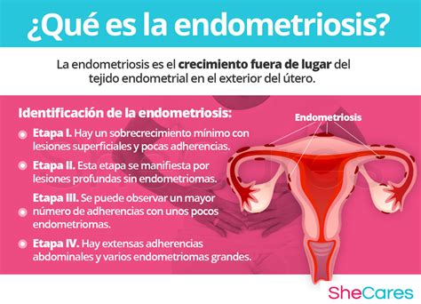 Endometriosis Shecares Hot Sex Picture