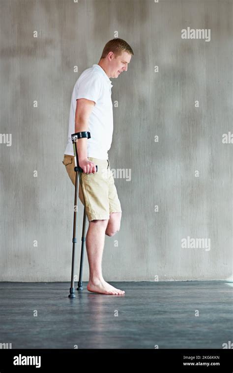 Man On Crutches One Leg Hi Res Stock Photography And Images Alamy