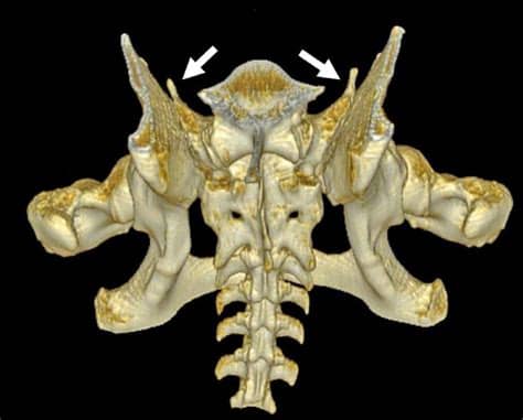 Alternative classification and screening protocol for ...