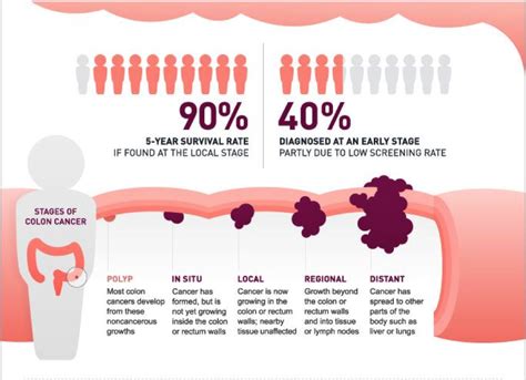 Colon Cancer Early Symptoms What Are The Early Signs